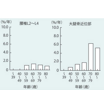 海綿骨構造指標